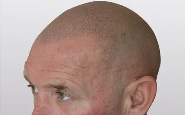 bf_2_2-min jos na micro haarpigmentatie